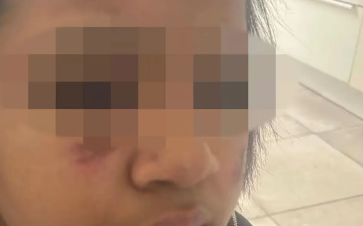 Molenbeek : Camilia, de 14 años, golpeada y quemada en la cara por ocho individuos