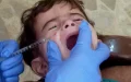 Alerta sanitaria : Leishmaniasis se extiende entre escolares marroquíes