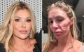Brandi Glanville : De estrella de reality a víctima de infección marroquí