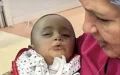 Empresario escocés se une a Operation Smile : Transformando vidas de niños marroquíes con labio leporino