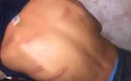 Escándalo en Marruecos : Profesor de islam agrede a alumno por respuesta sobre abejas