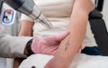 Escándalo en Val-d'Oise : Cierran salón de belleza por prácticas médicas ilegales y peligrosas