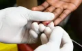 Marruecos casi ha cuadruplicado la reducción de las nuevas infecciones por VIH