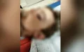 Pánico en El Havre : Rata gigante ataca a niño dormido