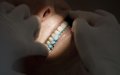 Sonrisas de lujo a precio de ganga : El boom del turismo dental en Marruecos seduce a los españoles