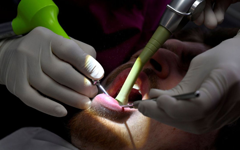 Alerta dental : El peligroso auge del turismo odontológico en Marruecos