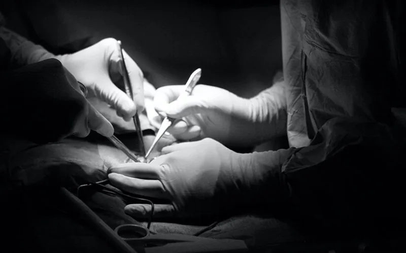 Escándalo en Val-d'Oise : Detienen a falso médico por circuncisiones ilegales y peligrosas