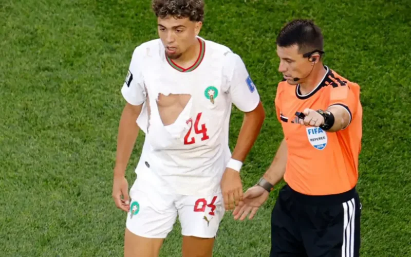 Marruecos-Escocia : La camiseta rasgada de Neil El Aynaoui avergüenza a Puma